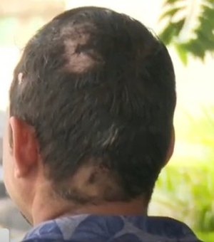 Taxista é agredido por passageiro com garrafa de vidro em Maceió
