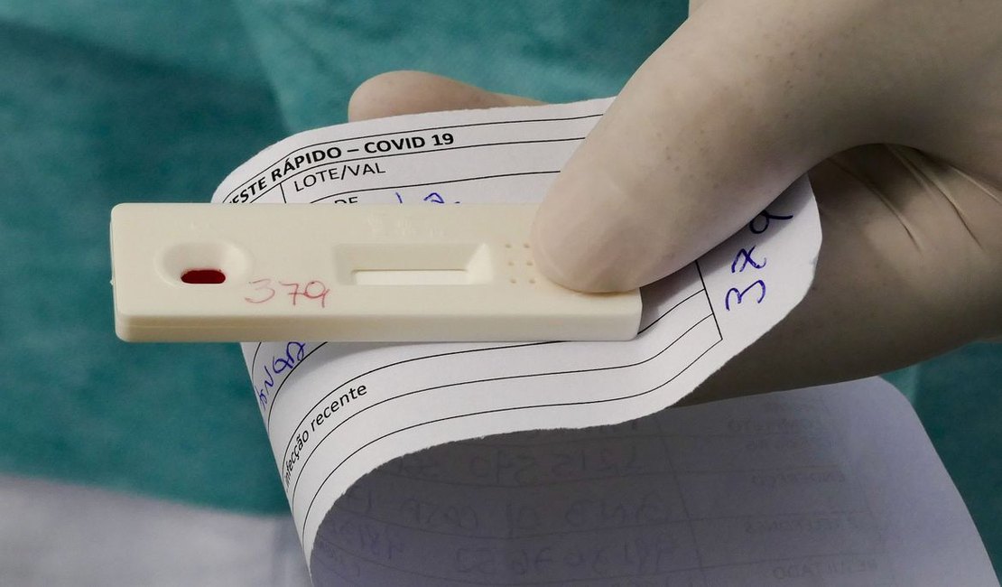 Alagoas ultrapassa 800 casos ativos da Covid-19, aponta boletim da Sesau