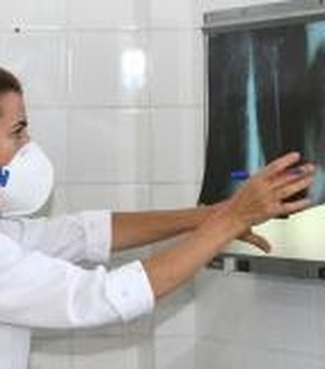 Delmiro Gouveia enfrenta um surto de tuberculose, diz Secretaria Municipal de Saúde