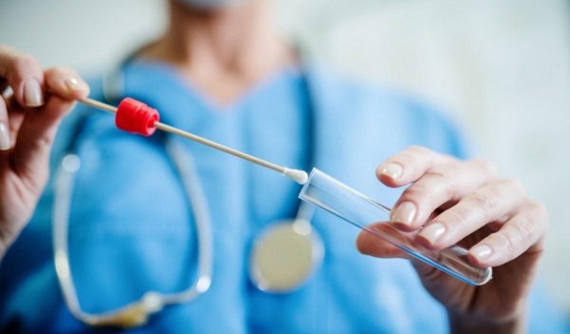 Arapiraca vai disponibilizar novos testes de Covid-19 com índice de acerto acima de 90%
