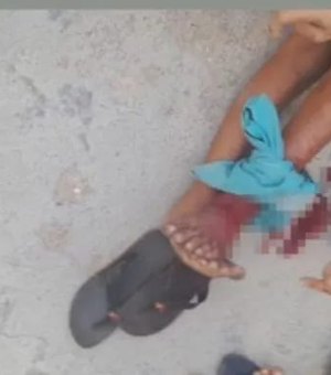Criança atacada por jacaré em Arapiraca se recupera em casa