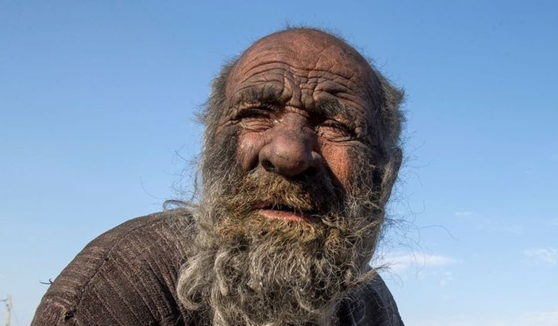 Morre aos 94 anos, Amou Haji, 'o homem mais sujo do mundo'