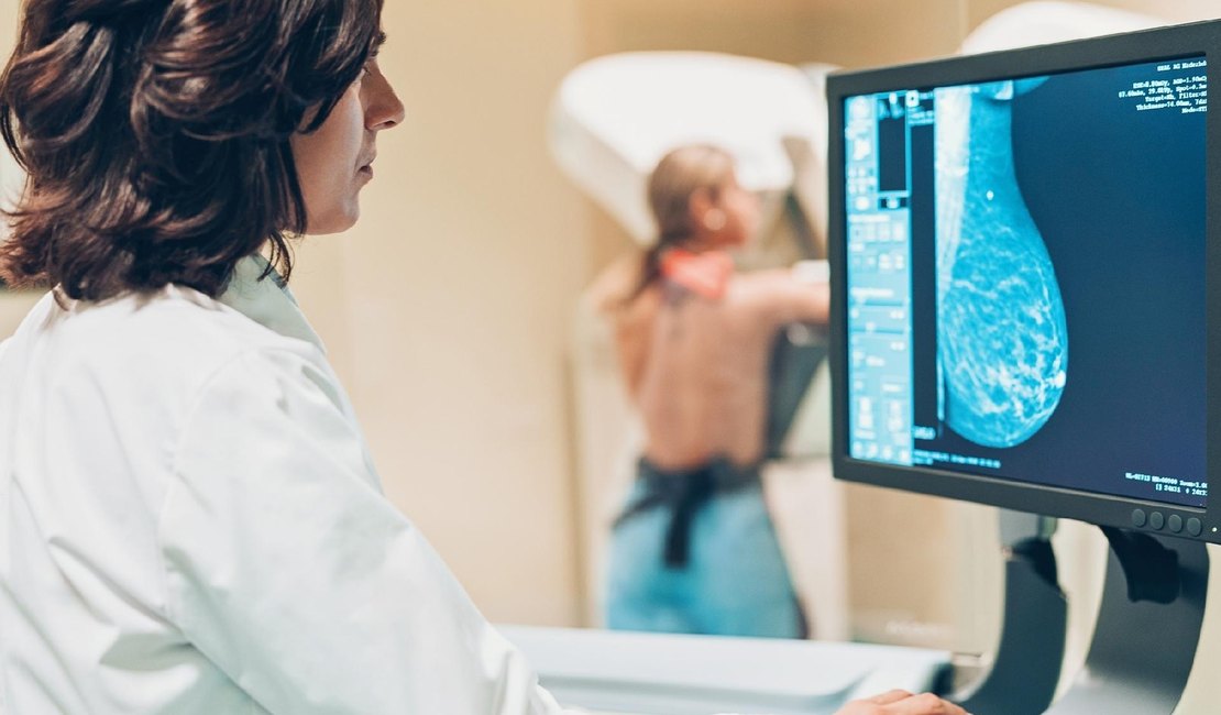 Alagoanas deixam de realizar mamografia e números preocupam especialistas