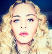 Madonna assume uso de botox no rosto e faz confissão sobre autoestima