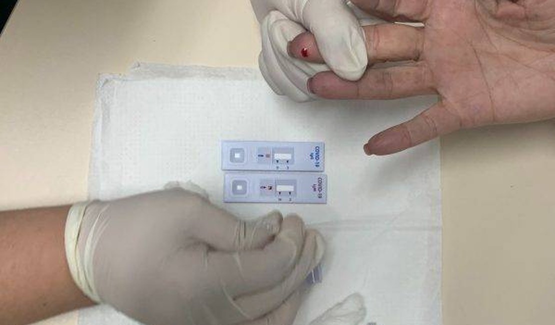 Vigilância Sanitária estabelece novas regras para testes rápidos em farmácias