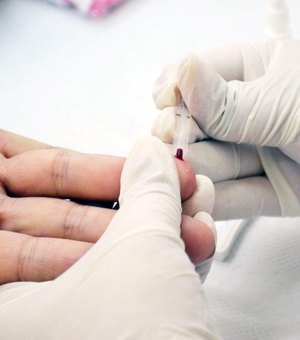 Testes de HIV revelam casos positivos acima da média do vírus em Alagoas