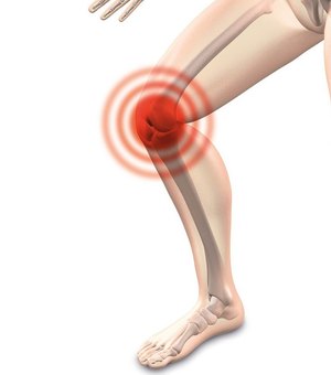 Pesquisa analisa uso da própolis vermelha em terapia para dores articulares