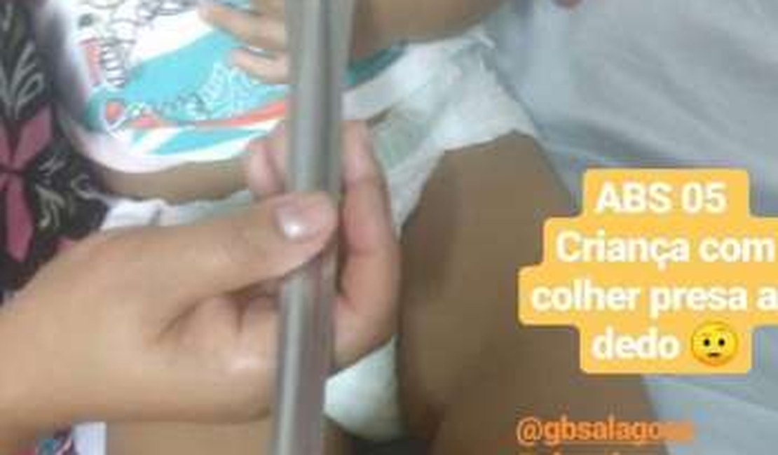 Criança de um ano prende dedo em objeto doméstico