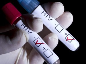 Casos de HIV em Maceió têm aumento no primeiro trimestre de 2017