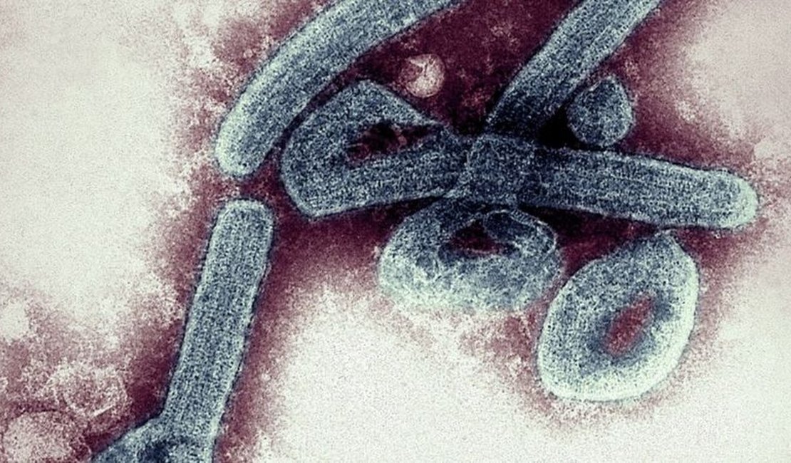 Doença 'prima' do Ebola faz vítima na Guiné e preocupa a OMS