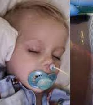 Criança de 2 anos passa por cirurgia após engolir 16 ímãs