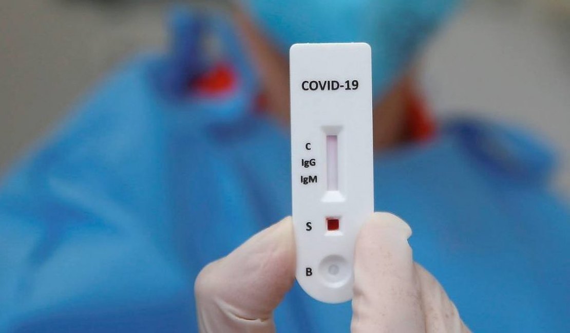 Hospital de Coruripe que atende pacientes de Covid-19 pelo SUS cobra R$ 300,00 por teste rápido