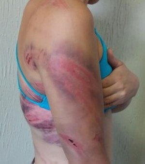 Colombiano é preso em Campinas suspeito de agredir mulher com mangueira de gás de cozinha