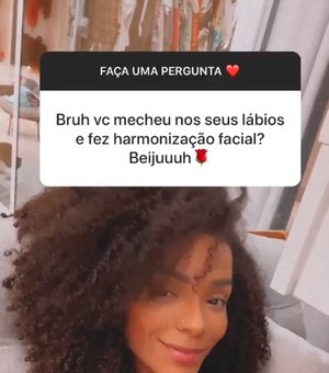 Brunna Gonçalves revela antes e depois da harmonização facial
