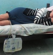 Em Alagoas, plano de saúde abandona paciente após erro médico em cirurgia