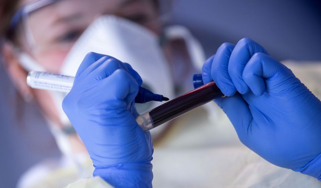 Covid-19: médicos dizem acreditar em subnotificação em casos e mortes