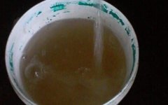Moradores reclamam da péssima qualidade e da falta d’água em Jundiá
