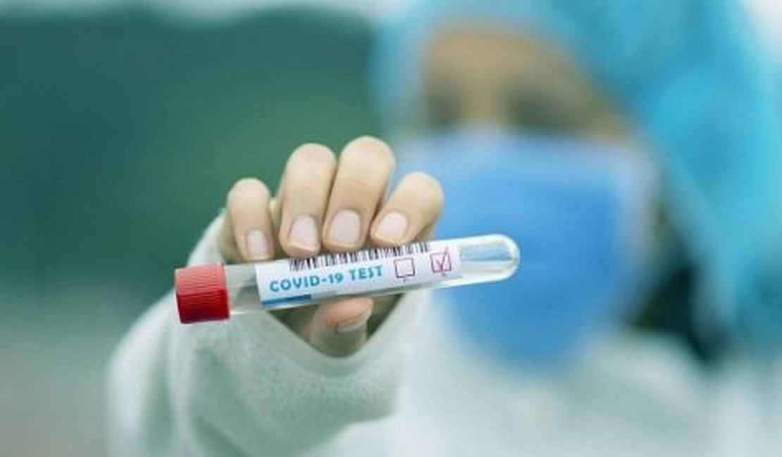 Teste de sorologia de Covid-19: ANS derruba liminar que garantia cobertura do exame