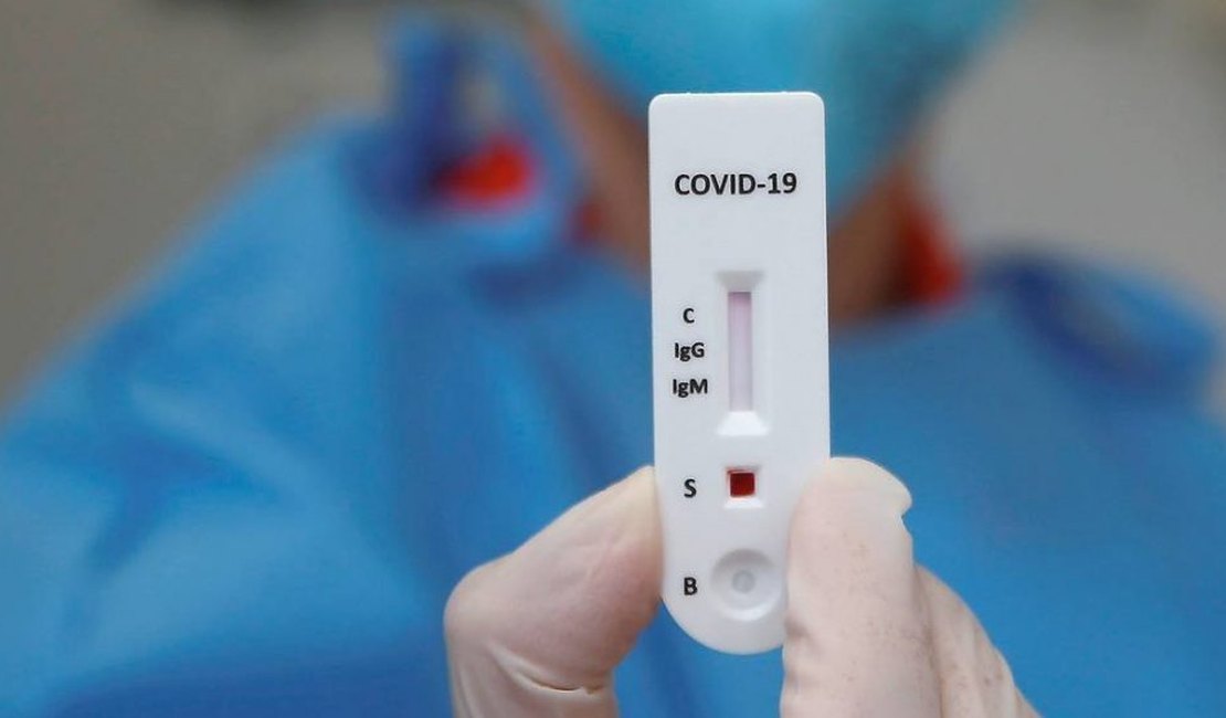 China aplica teste retal para identificar pessoas com covid-19