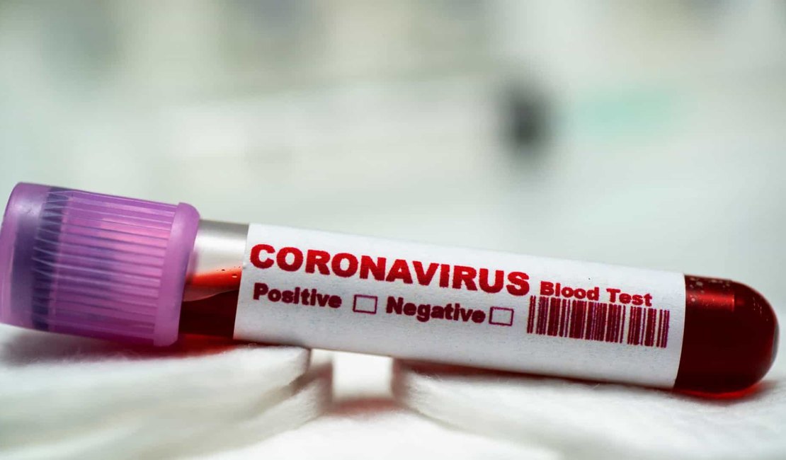Alagoas permanece com 11 casos confirmados para Covid-19 nesta quinta (26)