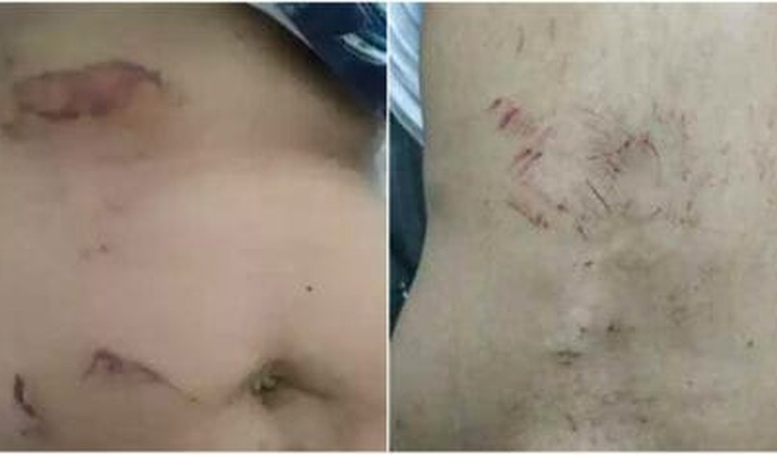 Homem tortura a mulher por ciúme e a faz comer pedaços de vidro