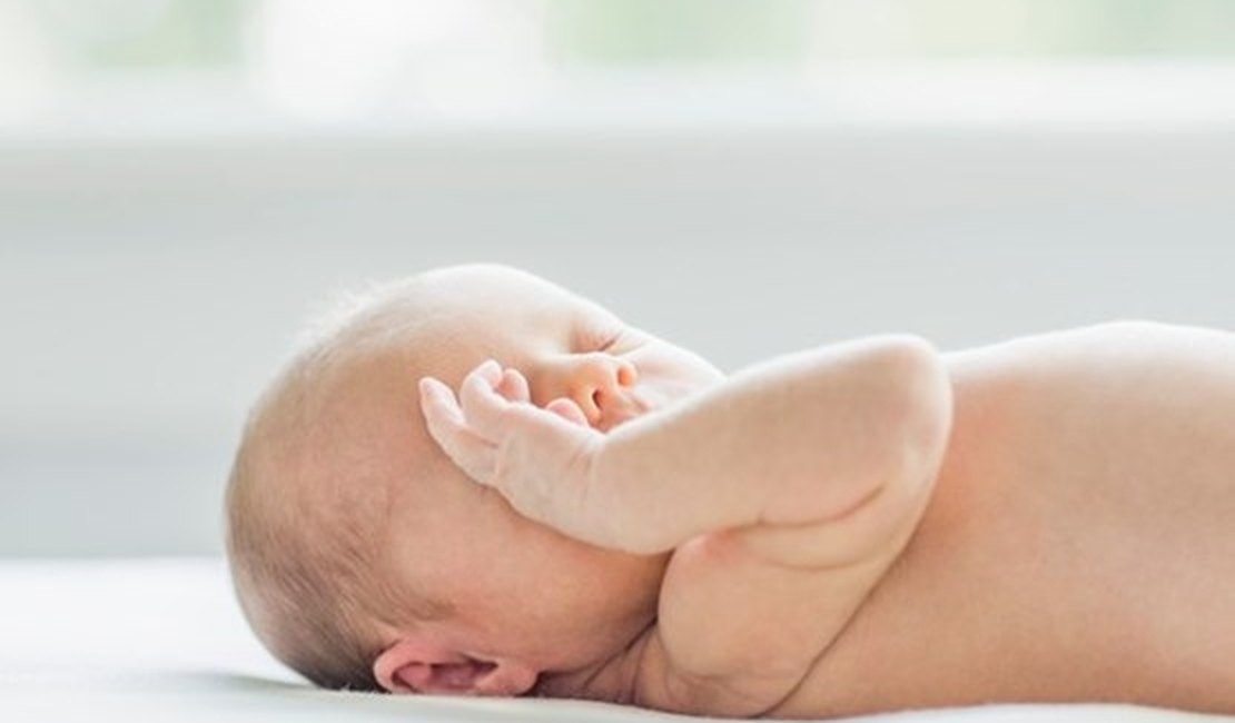 Zika vírus também pode afetar a visão do bebê
