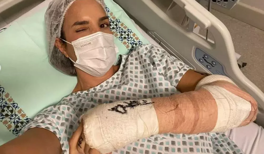 Ivete Sangalo passa por cirurgia no braço: ‘Mainha vai ficar zero bala’