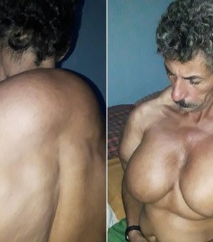 [Vídeo] Homem sofre de doença misteriosa que faz crescer os músculos