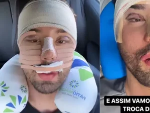 Rico faz cirurgia após ser julgado de feio: 'Começar a trocar de rosto'