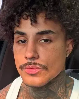 MC Livinho deixa a UTI; veja o estado de saúde do cantor