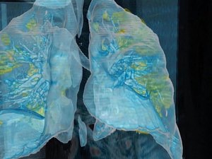 Maceió terá centro de especialidades para tratar sequelas da Covid-19