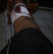 [Vídeo] Jovem desacata ordem policial e é atingido por um bala de borracha, em Porto Calvo