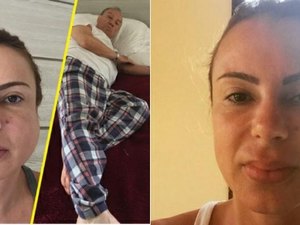 Mulher de Stênio Garcia, sofre com caxumba e desabafa