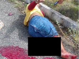 Mototaxista tem perna decepada em grave acidente