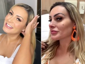 Andressa Urach faz preenchimento no nariz e no queixo: 'Fiquei com cara de rica'