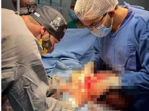 Médicos retiram tumores pesando quase 11 kg de paciente idosa