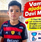Criança de São Sebastião sofre acidente e família pede ajuda para custear tratamento