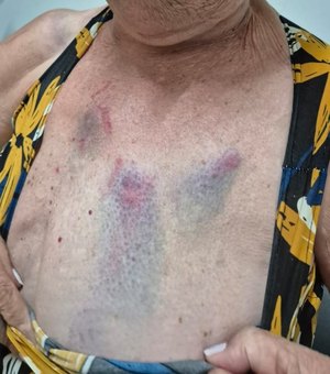 Médica que agrediu tia idosa de 77 anos é presa pela segunda vez em Arapiraca