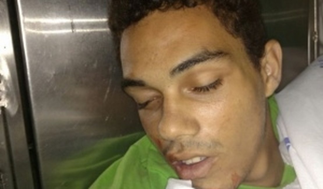 Políciais Militares ficam feridos após troca de tiros em Maceió