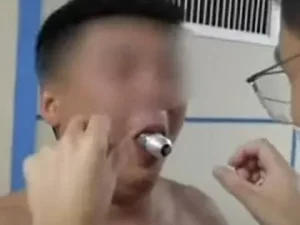 Homem prende lâmpada na boca por desafio e vai parar no hospital na China