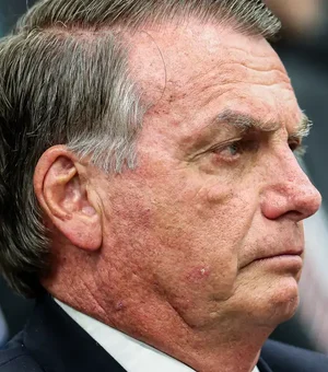 Bolsonaro pede autorização do STF para fazer procedimento médico