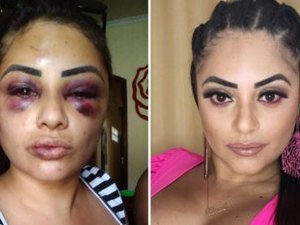 Inlfuencer é agredida a pauladas em SP: “Tentaram furar meus olhos”