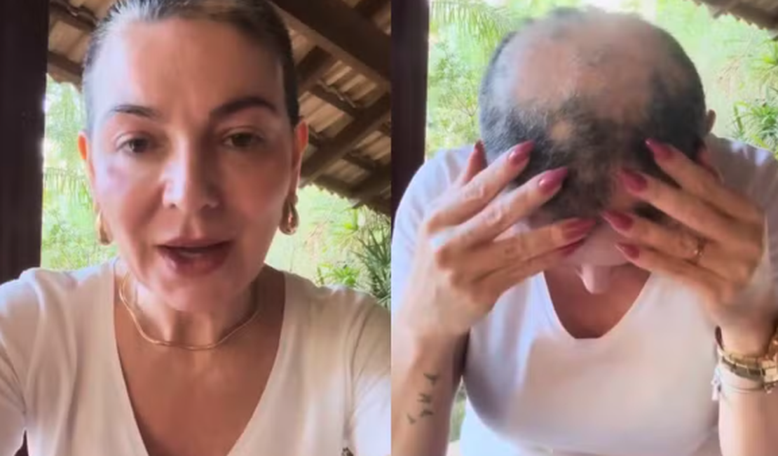 Mãe de Lucas Lucco revela volta da alopecia