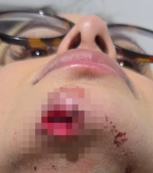 Justiça nega prisão preventiva de suspeito de arrastar influenciadora com carro em Maceió