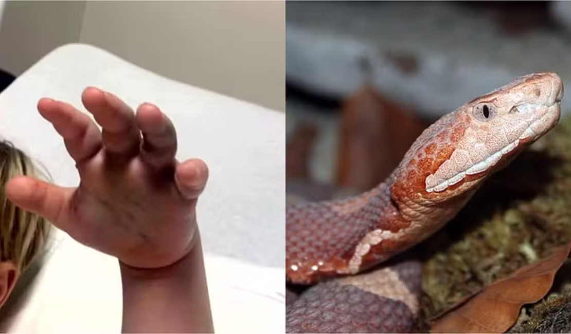Menino de 4 anos é picado por cobra venenosa, e creche não aciona emergência: 'Achei que fosse uma farpa'