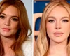 Lindsay Lohan gastou R$ 1,7 milhão para rejuvenescer, diz especialista