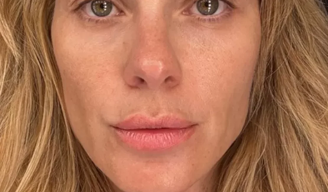 Carolina Dieckmann divulga foto sem filtro: 'Felizinha com minha pele'