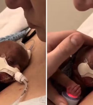 Mulher abraça seu bebê prematuro em 'despedida', mas acaba surpreendida pelo desfecho