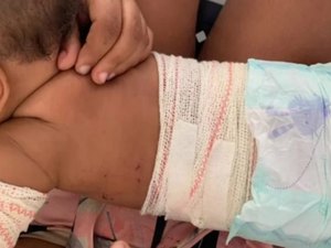 Bebê é atingida por rojão após discussão por uso de máscara em bar