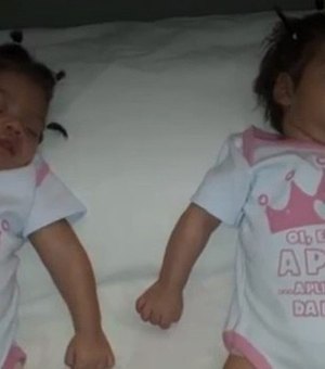 Gêmeas que não acordam desde que nasceram têm risco de sequelas
